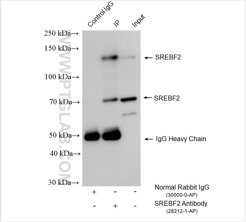 Immunoprecipitation (IP) experiment of HeLa cells using SREBF2 Polyclonal antibody (28212-1-AP)