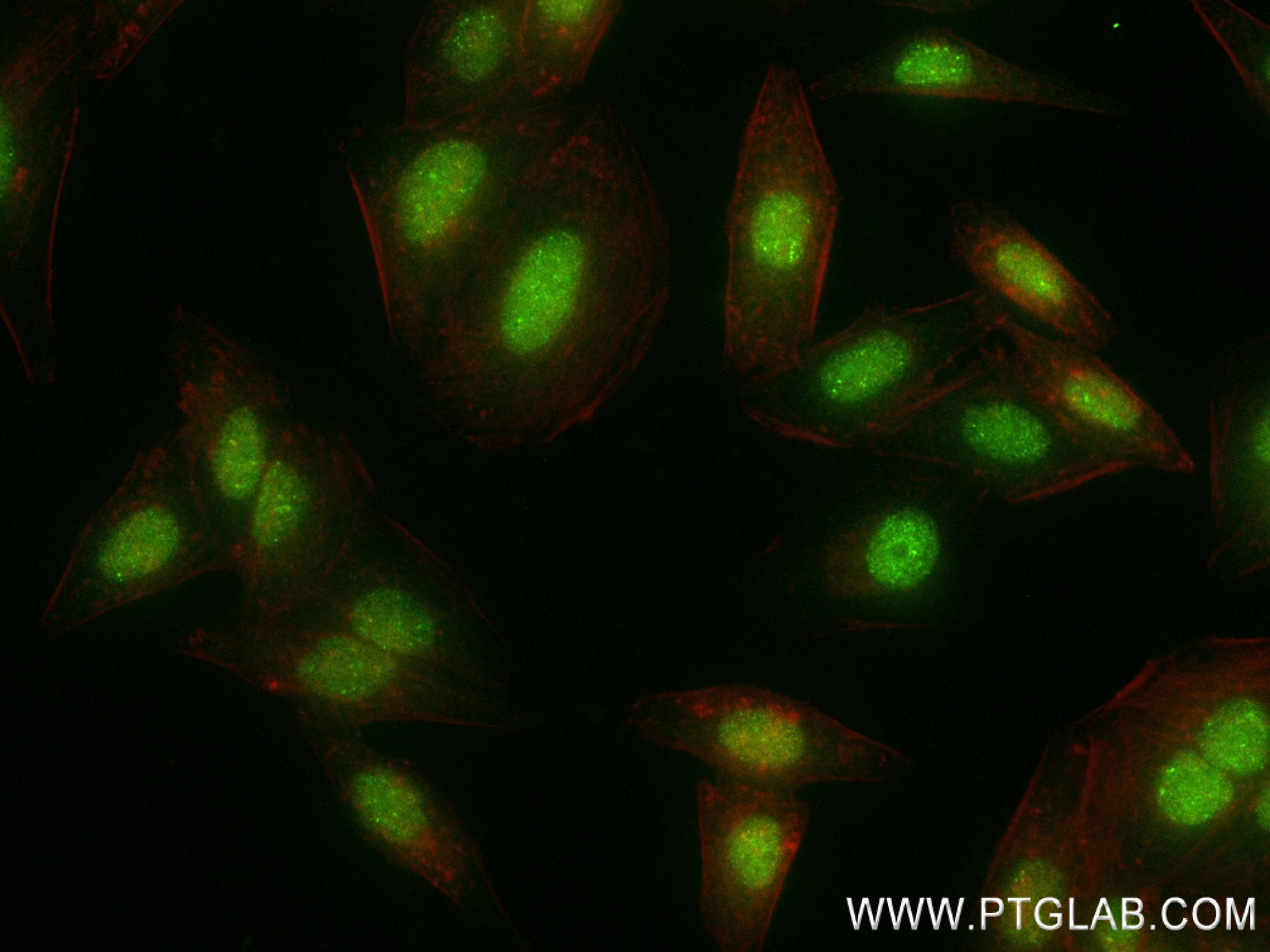 Immunofluorescence (IF) / fluorescent staining of HepG2 cells using SREBF2 Recombinant antibody (83403-1-RR)