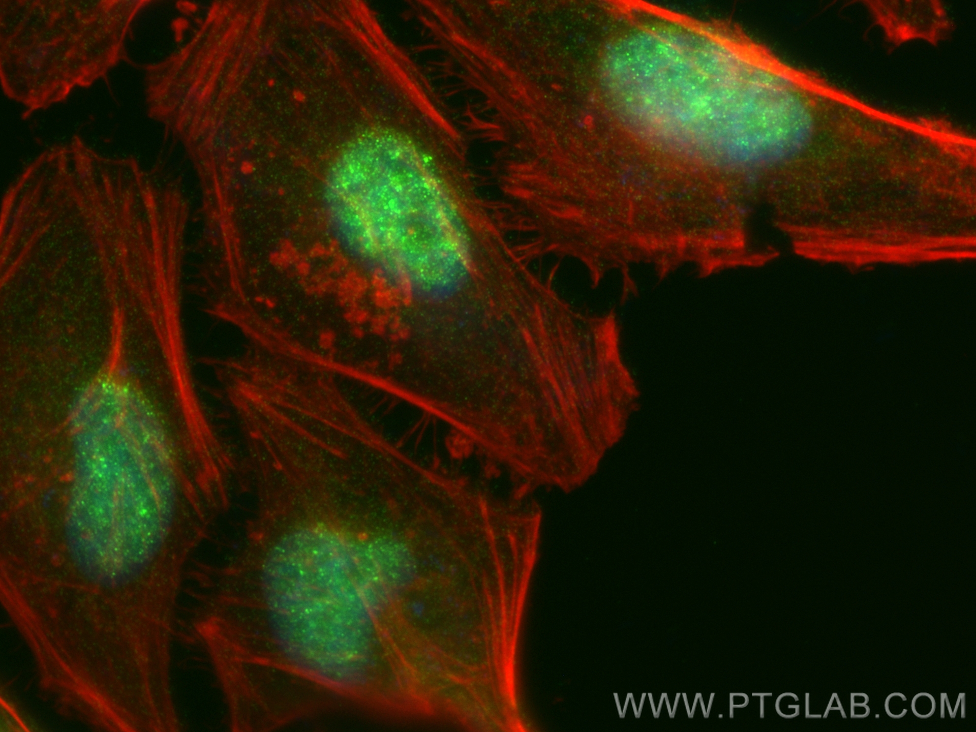 Immunofluorescence (IF) / fluorescent staining of HeLa cells using SREBF2 Recombinant antibody (83403-1-RR)