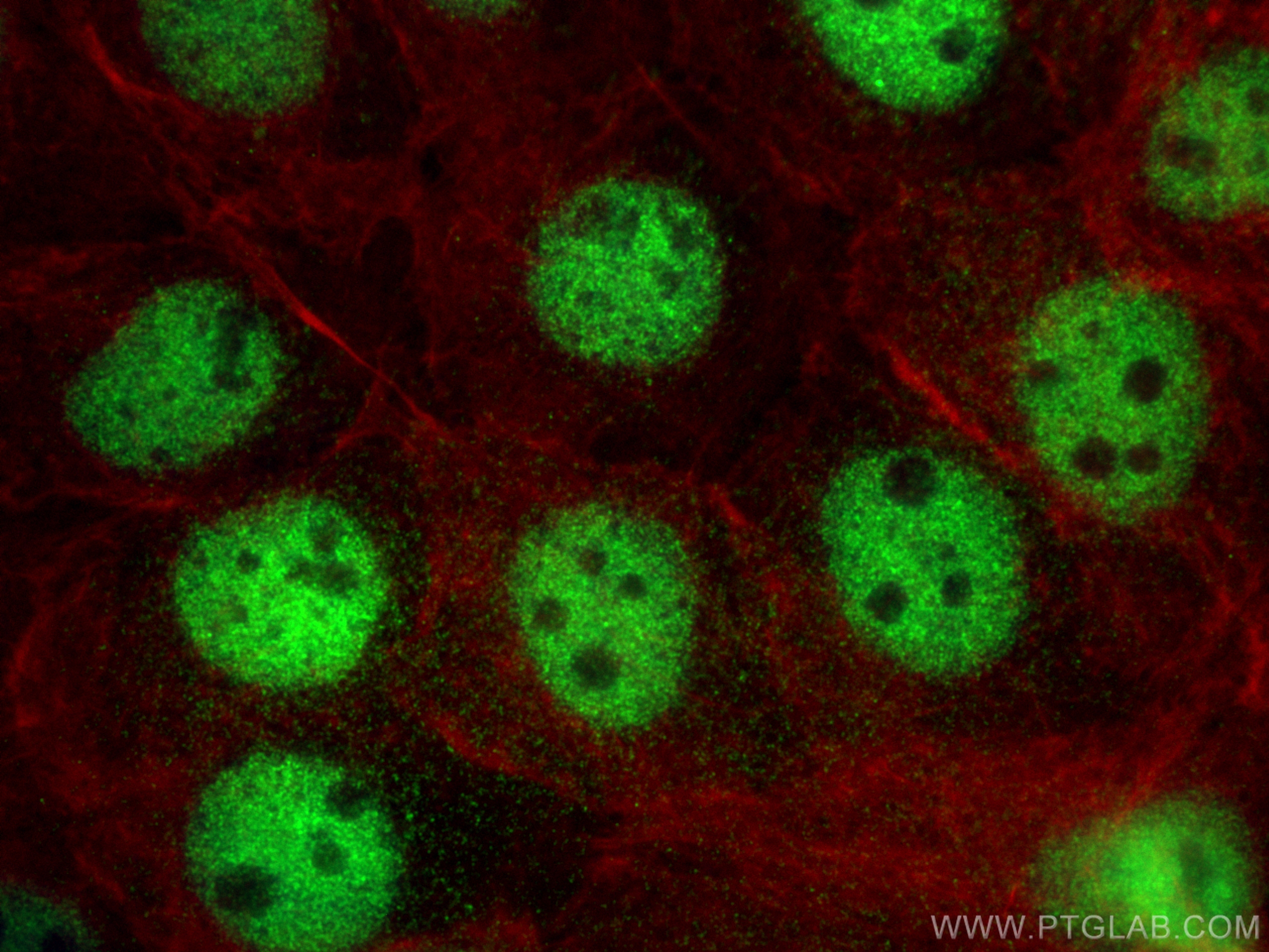 Immunofluorescence (IF) / fluorescent staining of A431 cells using SRF Polyclonal antibody (16821-1-AP)