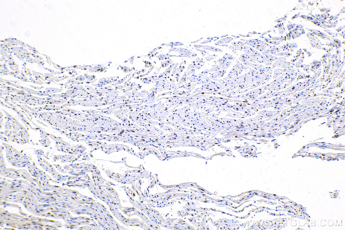 Immunohistochemistry (IHC) staining of mouse heart tissue using SRF Polyclonal antibody (16821-1-AP)