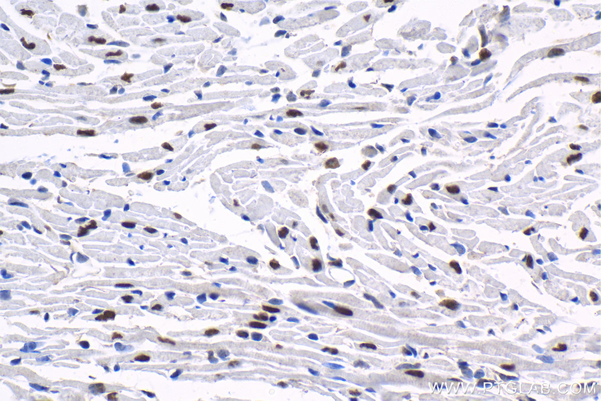 Immunohistochemistry (IHC) staining of mouse heart tissue using SRF Polyclonal antibody (16821-1-AP)