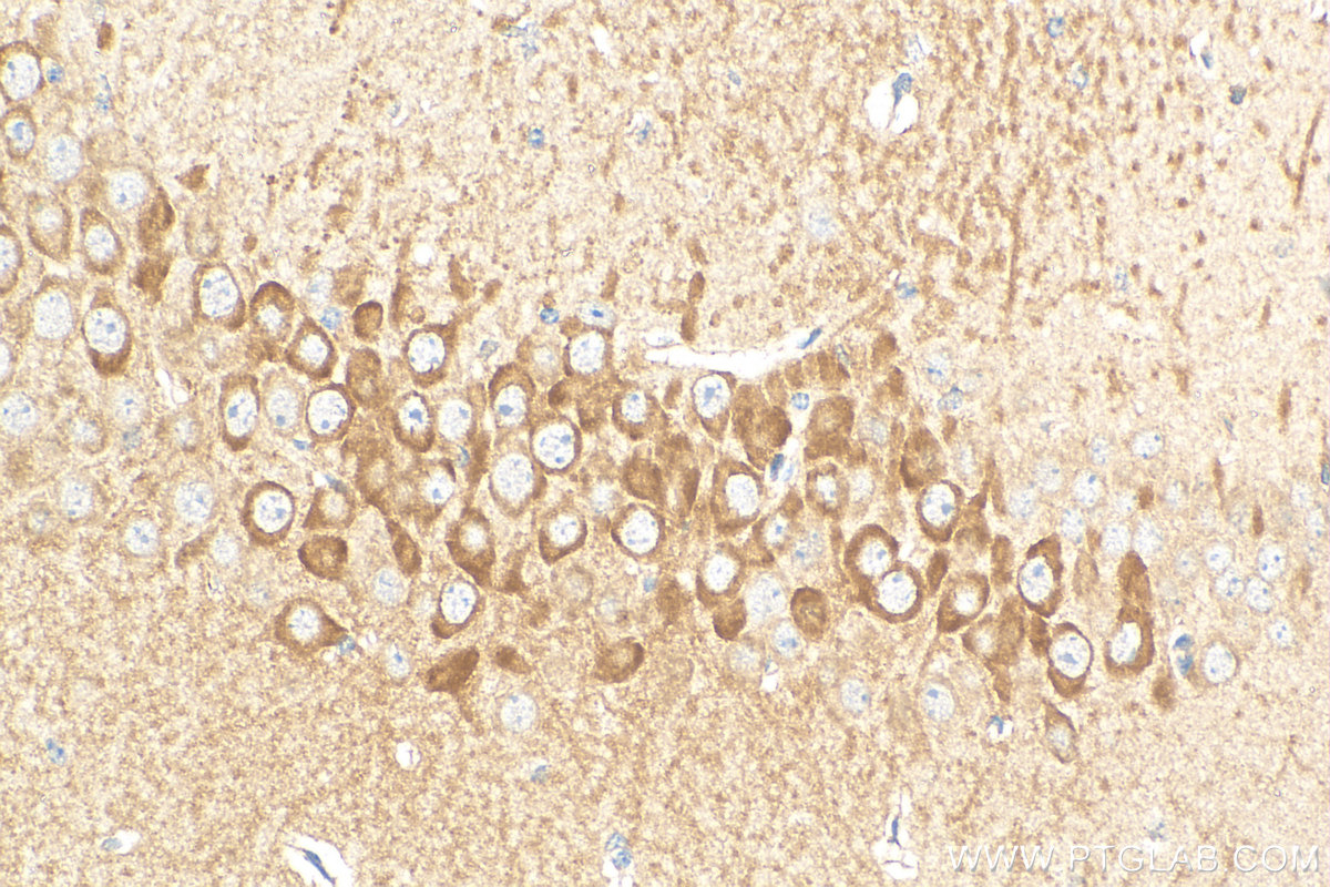 Immunohistochemistry (IHC) staining of mouse brain tissue using SRGAP2 Polyclonal antibody (22519-1-AP)