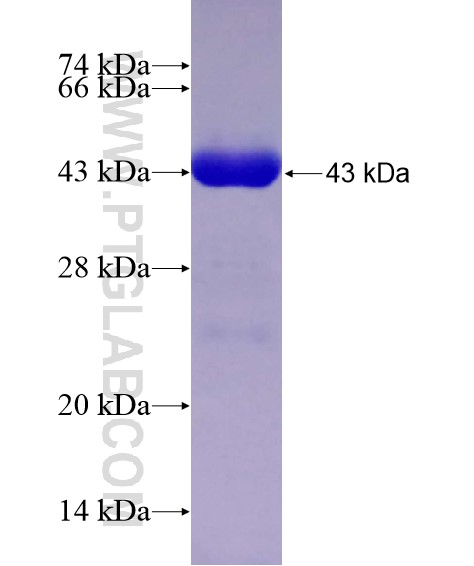 SRGAP3 fusion protein Ag28571 SDS-PAGE