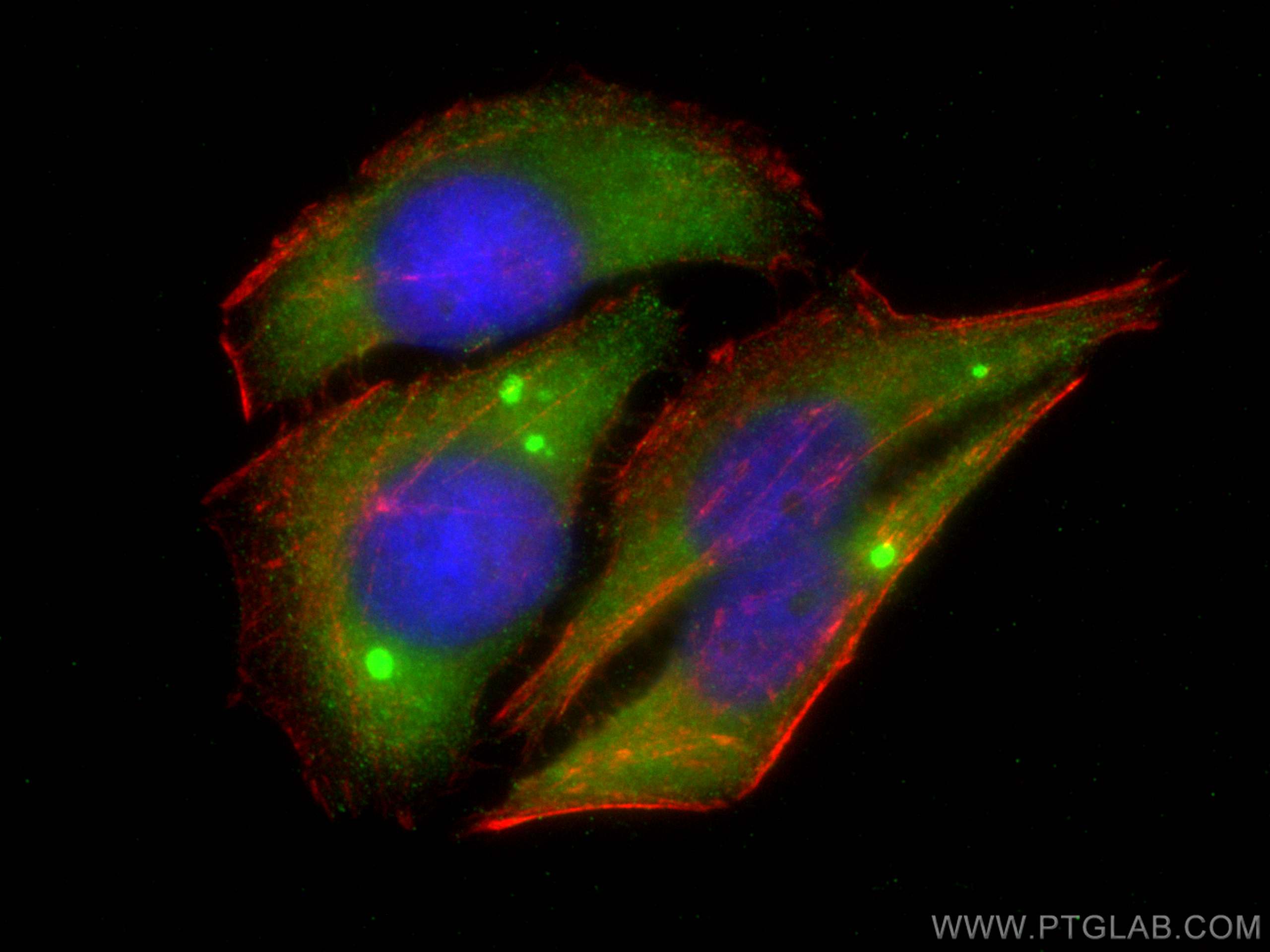 Immunofluorescence (IF) / fluorescent staining of HepG2 cells using SRI Polyclonal antibody (16471-1-AP)