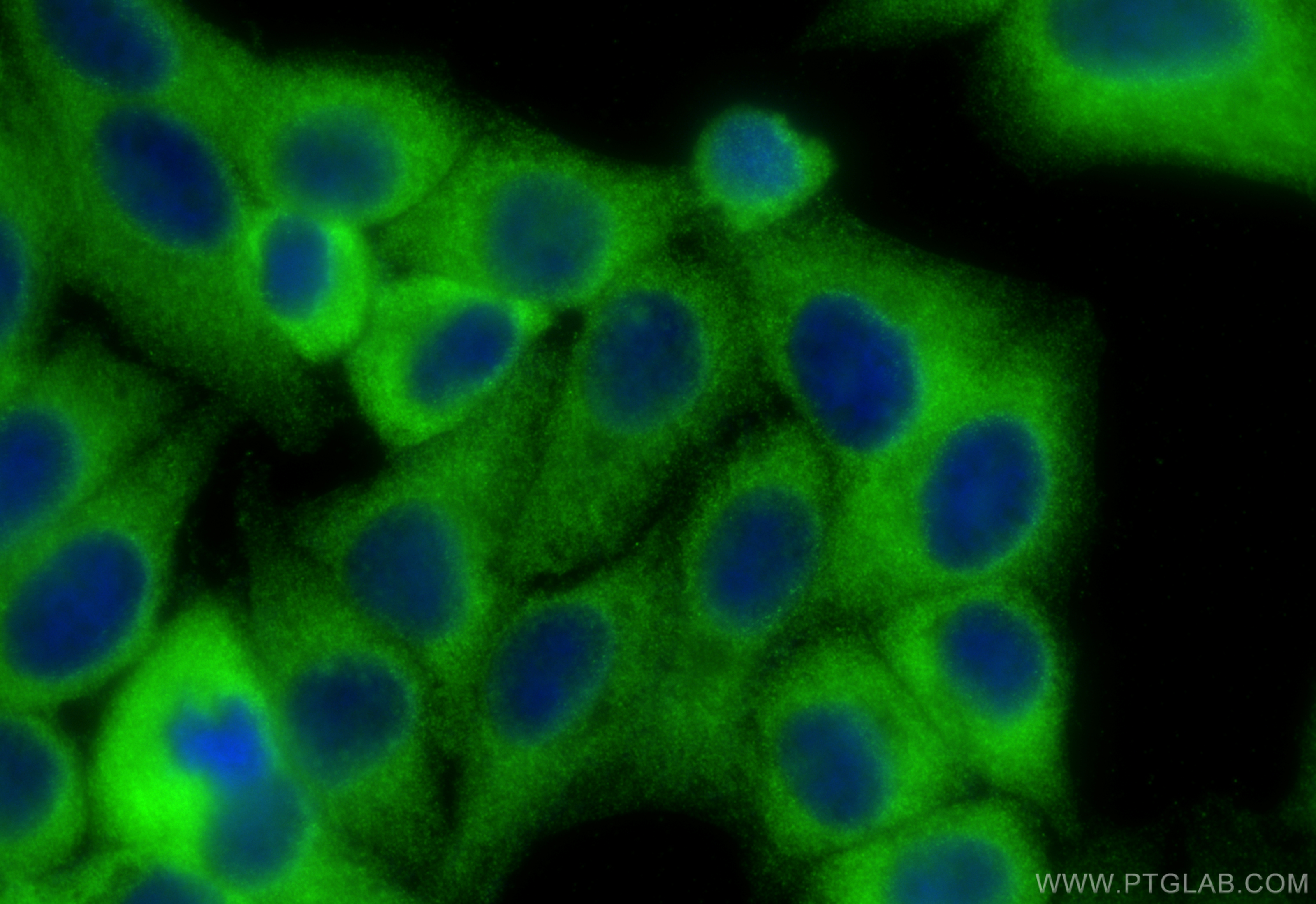 Immunofluorescence (IF) / fluorescent staining of HepG2 cells using SRP14 Polyclonal antibody (11528-1-AP)