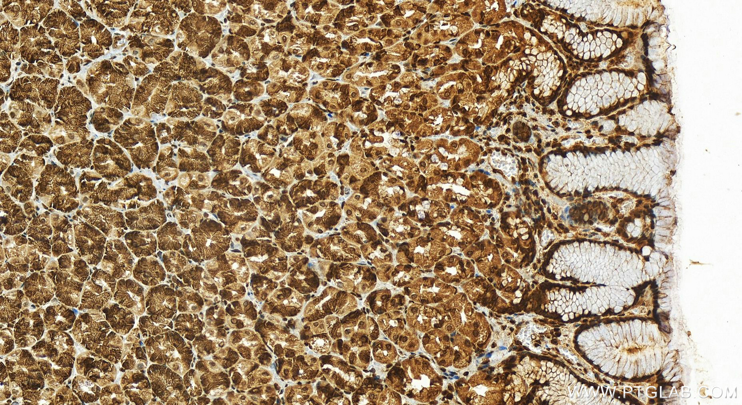 Immunohistochemistry (IHC) staining of human stomach tissue using SRP19 Polyclonal antibody (16033-1-AP)