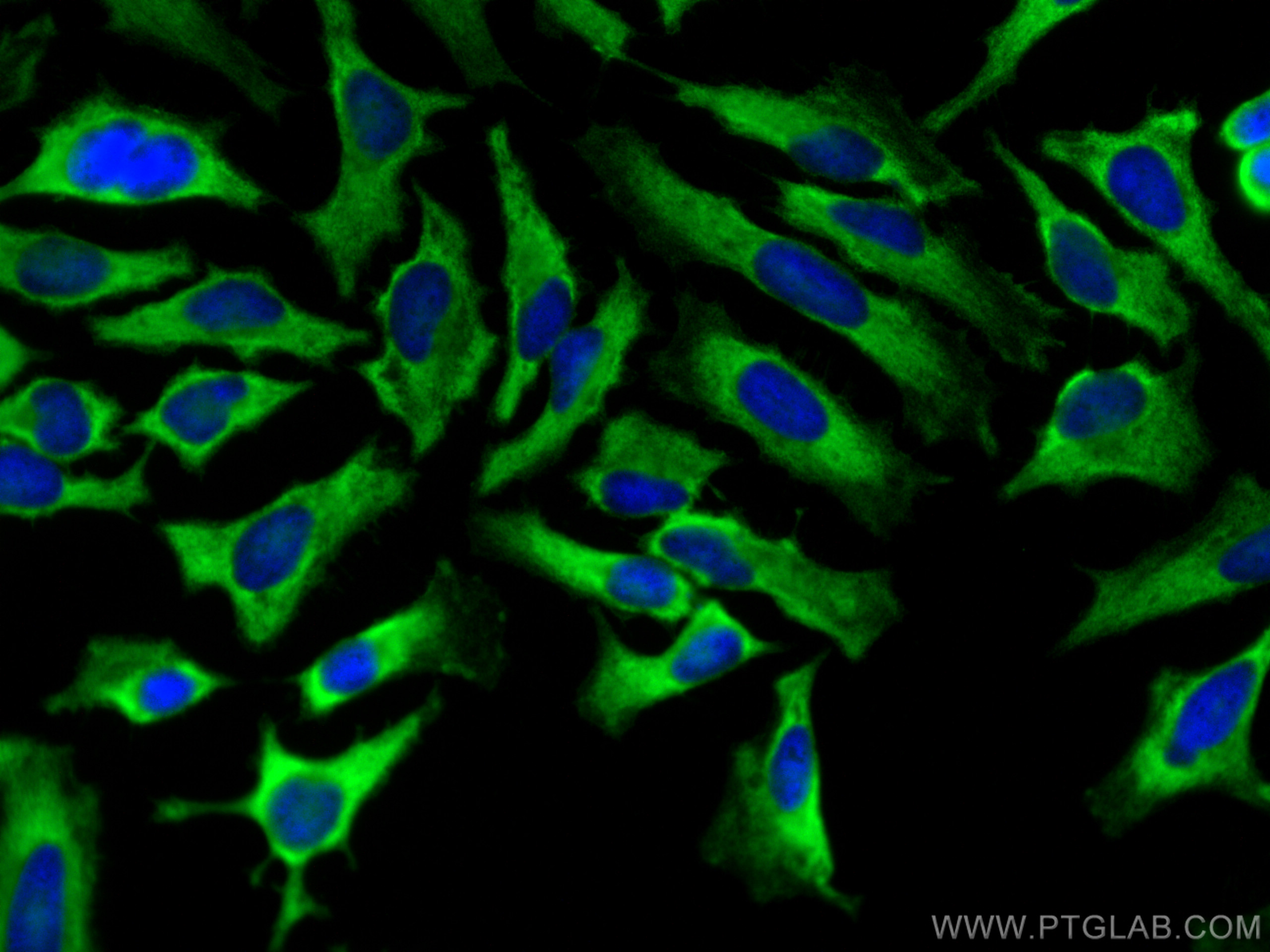 Immunofluorescence (IF) / fluorescent staining of HeLa cells using SRP19 Polyclonal antibody (16033-1-AP)