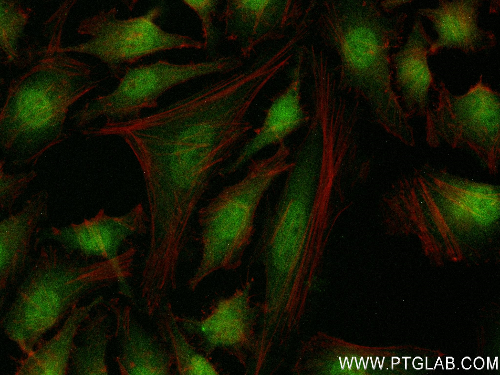 Immunofluorescence (IF) / fluorescent staining of HeLa cells using SRP19 Recombinant antibody (84061-3-RR)