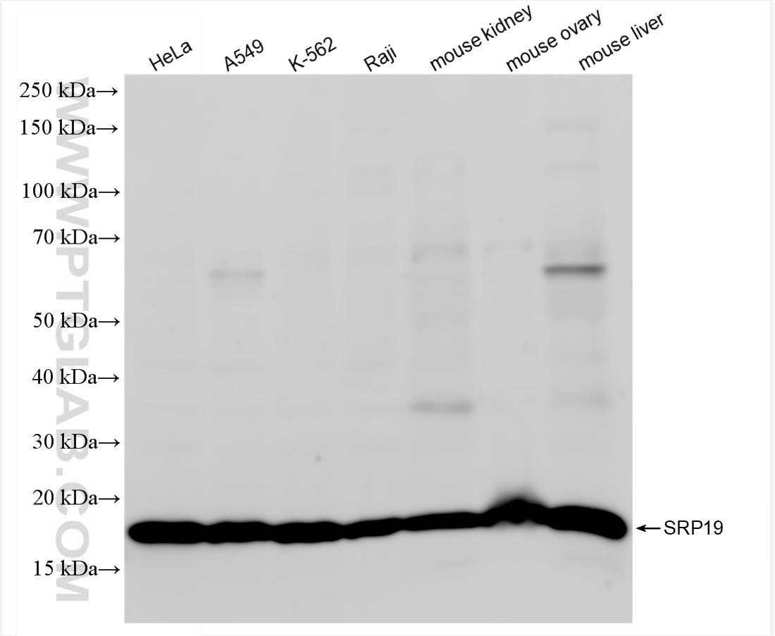 Western Blot (WB) analysis of various lysates using SRP19 Recombinant antibody (84061-3-RR)