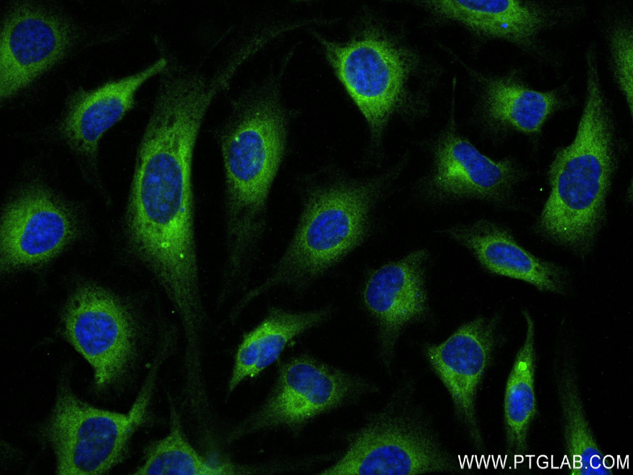 Immunofluorescence (IF) / fluorescent staining of HeLa cells using SRP54 Recombinant antibody (84014-5-RR)