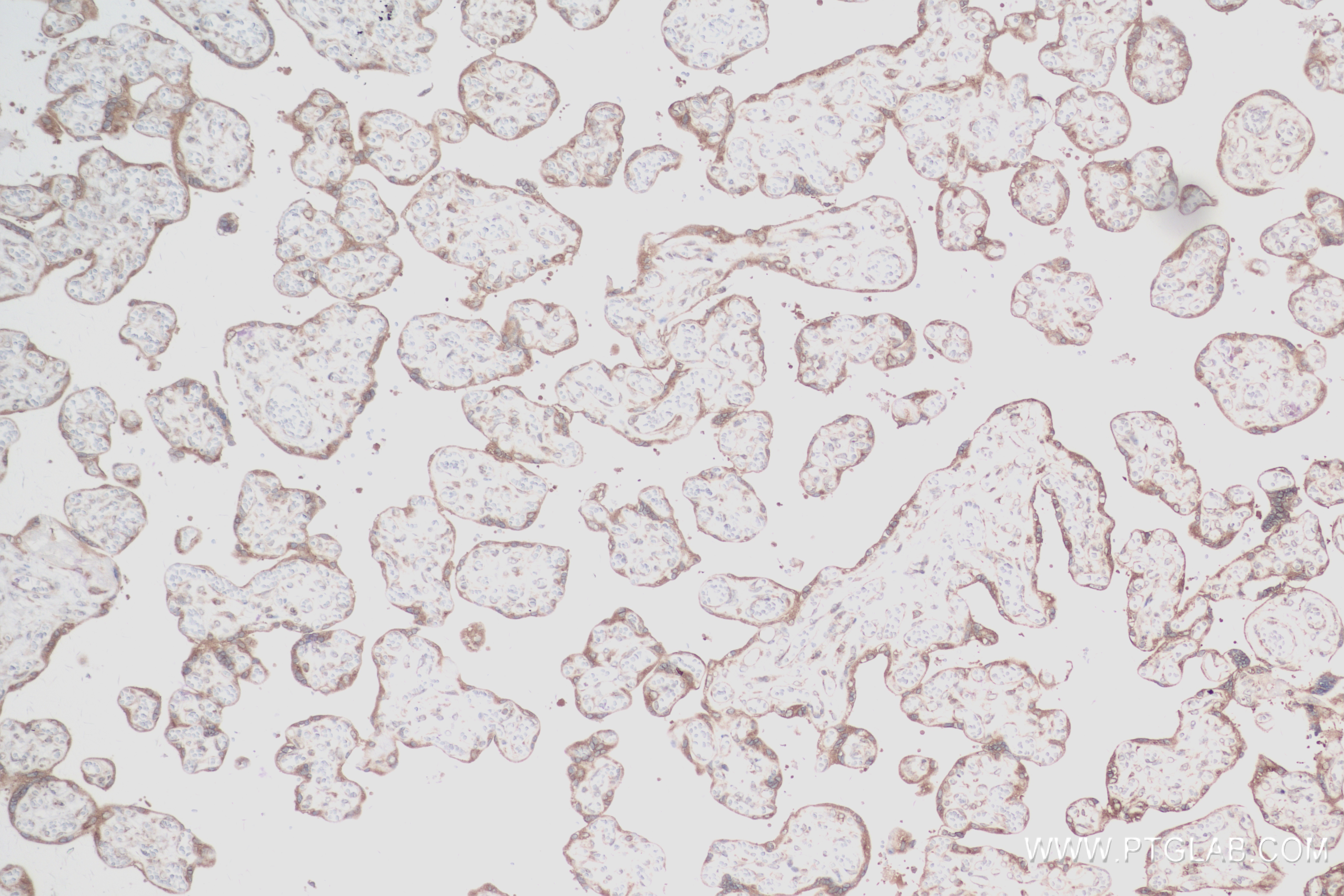 Immunohistochemistry (IHC) staining of human placenta tissue using SRP54 Recombinant antibody (84014-6-RR)