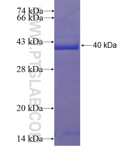 SRRD fusion protein Ag23829 SDS-PAGE