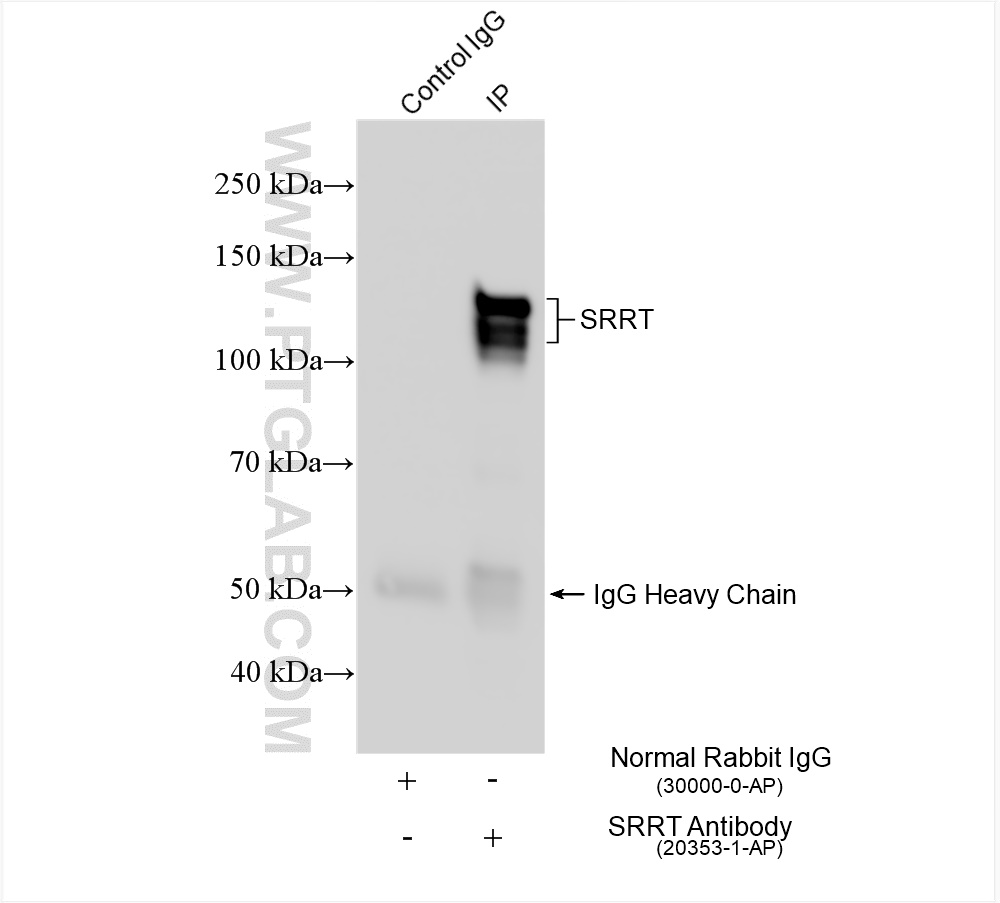 Immunoprecipitation (IP) experiment of Jurkat cells using SRRT Polyclonal antibody (20353-1-AP)