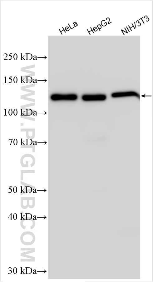 Western Blot (WB) analysis of various lysates using SRRT Polyclonal antibody (20353-1-AP)