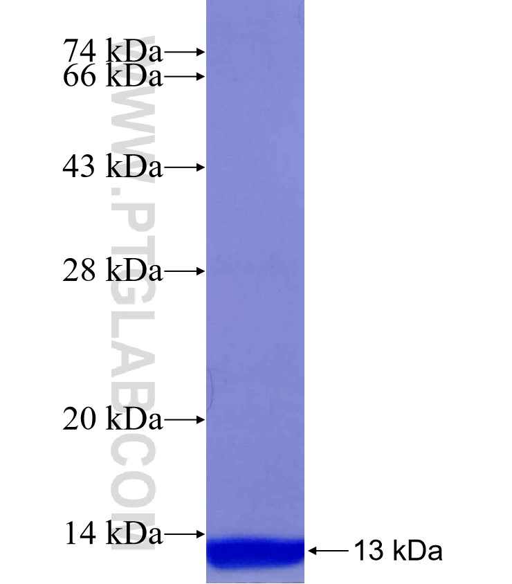 SS18 fusion protein Ag30104 SDS-PAGE