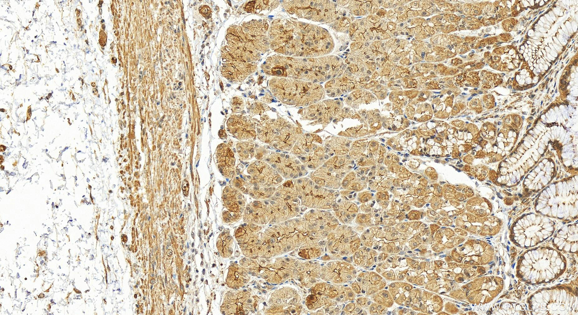 Immunohistochemistry (IHC) staining of human stomach tissue using KRAP/SSFA2 Polyclonal antibody (14157-1-AP)