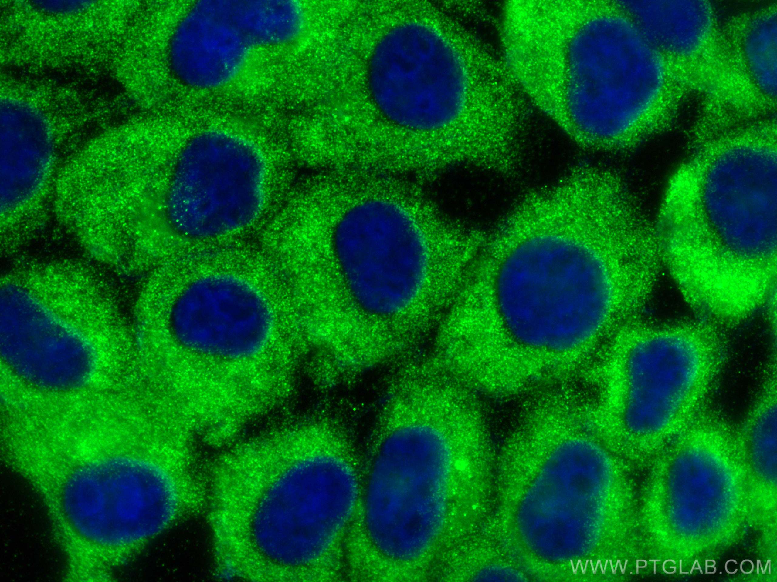 Immunofluorescence (IF) / fluorescent staining of A431 cells using SSH3 Polyclonal antibody (18324-1-AP)