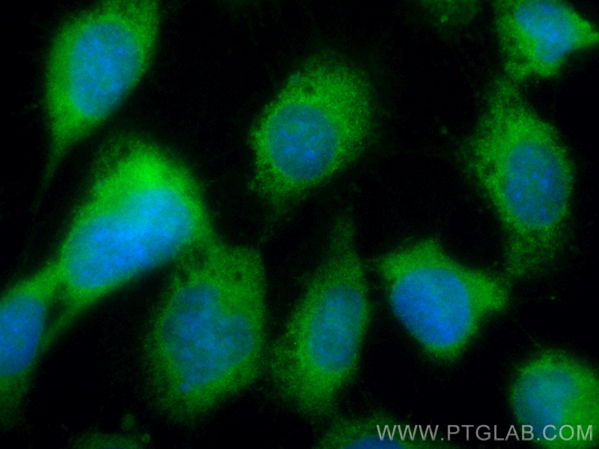 Immunofluorescence (IF) / fluorescent staining of A431 cells using CoraLite® Plus 488-conjugated SSH3 Polyclonal anti (CL488-18324)