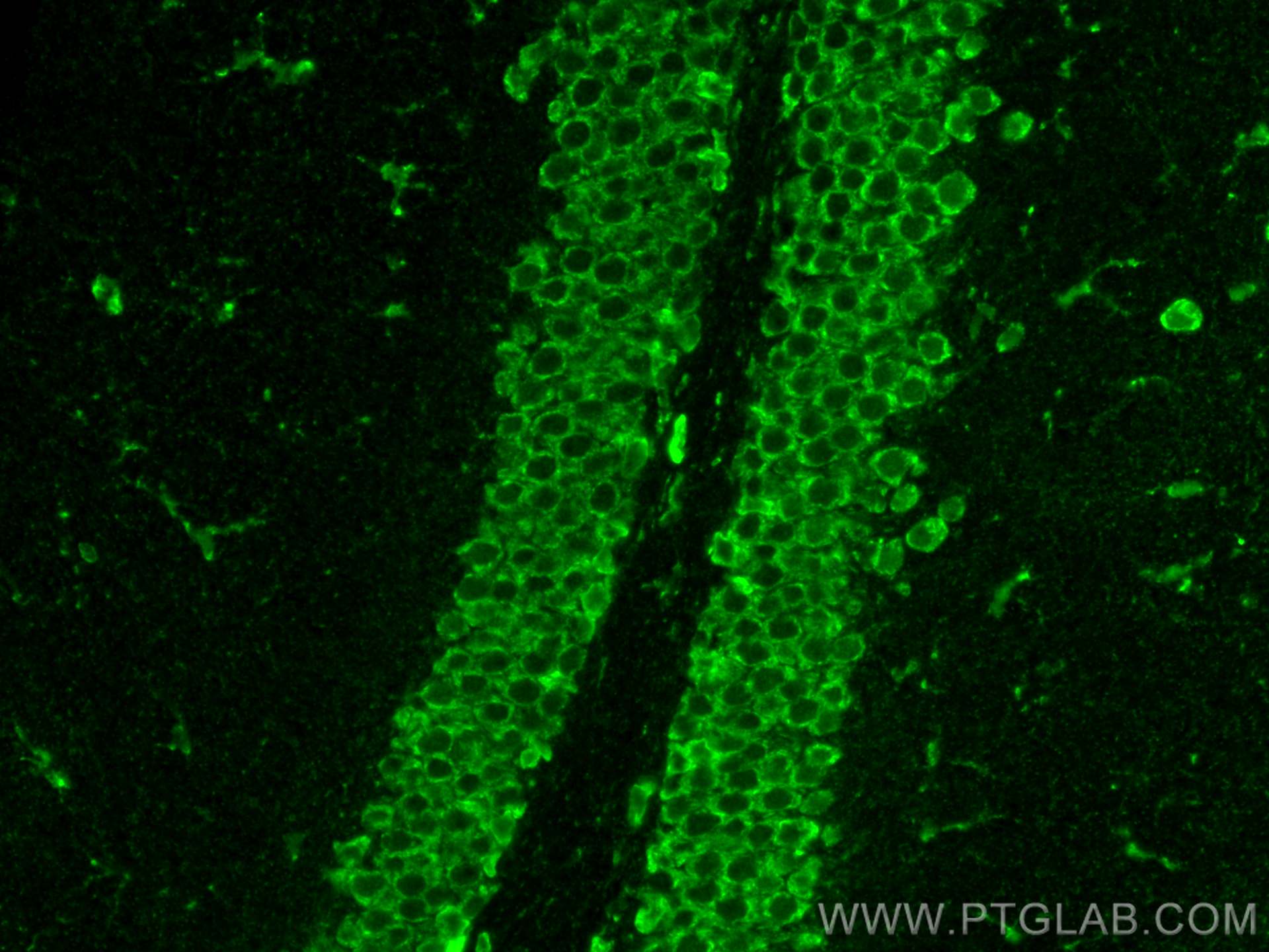 Immunofluorescence (IF) / fluorescent staining of mouse brain tissue using SSR3 Polyclonal antibody (30851-1-AP)