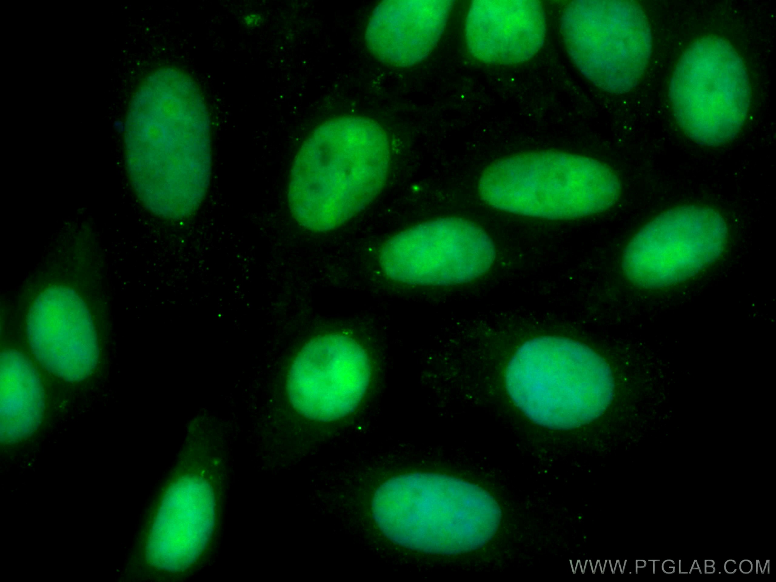 Immunofluorescence (IF) / fluorescent staining of HepG2 cells using CoraLite® Plus 488-conjugated SSRP1 Monoclonal ant (CL488-67313)