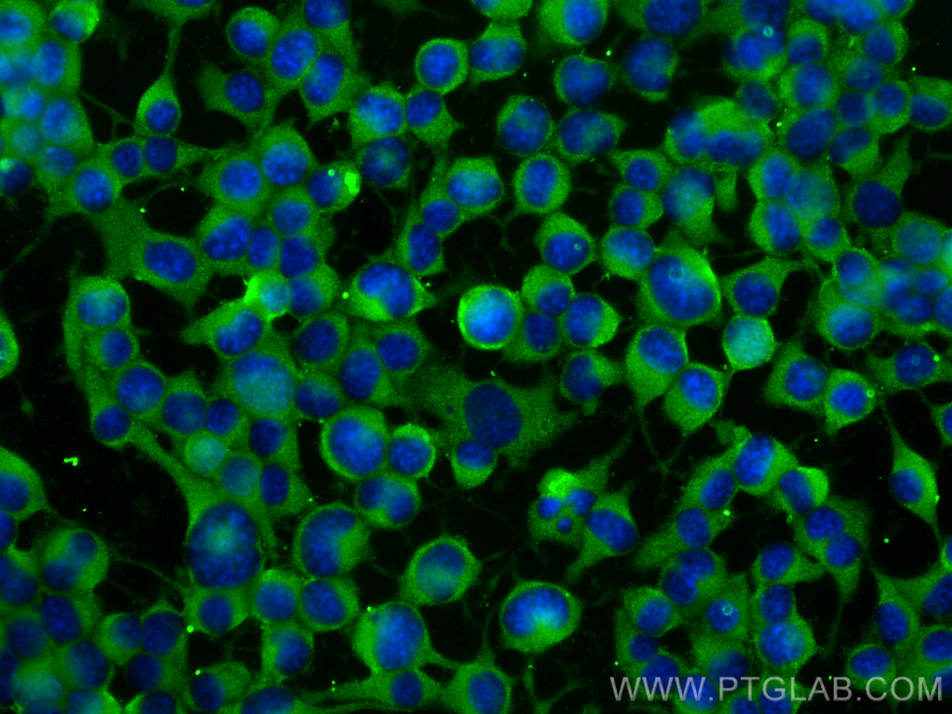 Immunofluorescence (IF) / fluorescent staining of Neuro-2a cells using SSTR2 Polyclonal antibody (20404-1-AP)