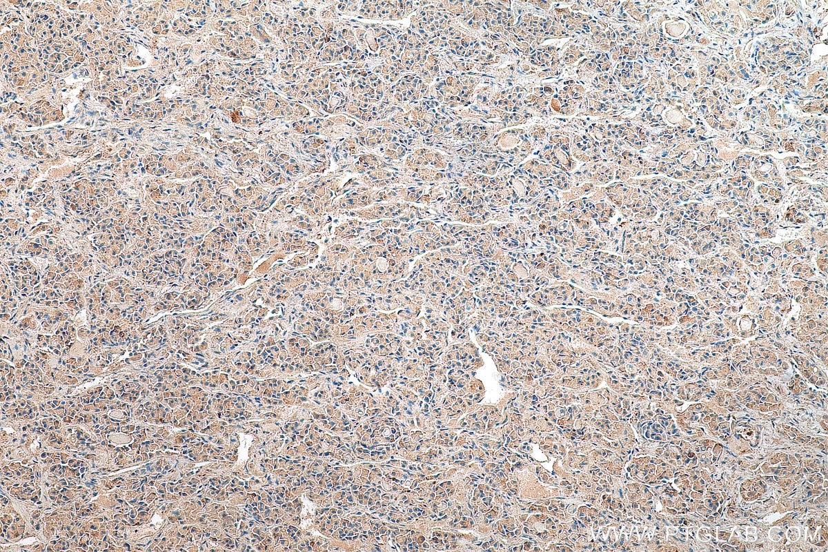Immunohistochemistry (IHC) staining of human pituitary tissue using SSTR3 Polyclonal antibody (20696-1-AP)