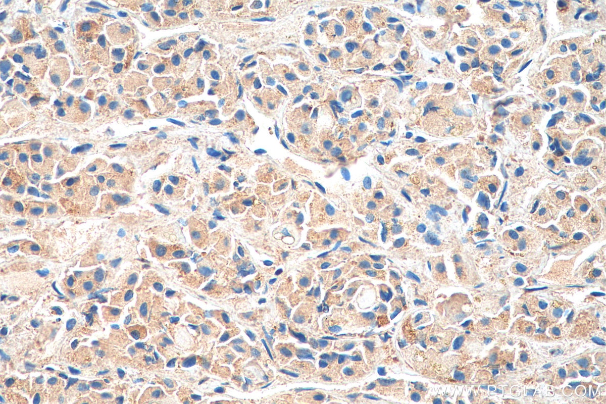 Immunohistochemistry (IHC) staining of human pituitary tissue using SSTR3 Polyclonal antibody (20696-1-AP)