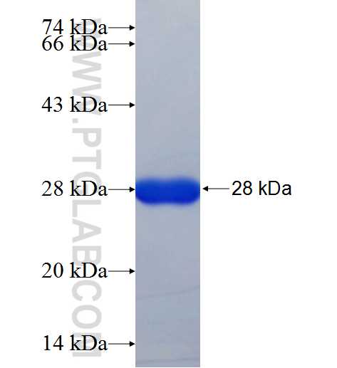 SSX2 fusion protein Ag25975 SDS-PAGE