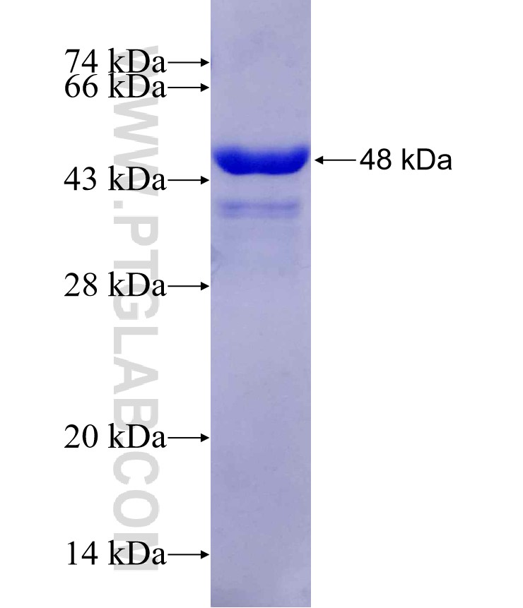 SSX2 fusion protein Ag25982 SDS-PAGE