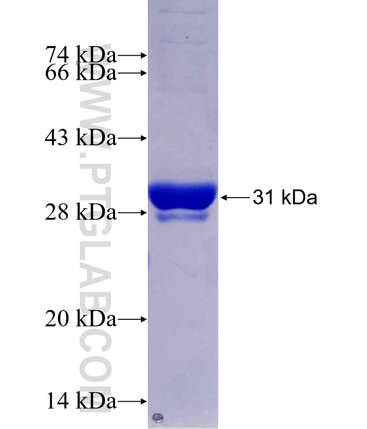 SSX2 fusion protein Ag29788 SDS-PAGE