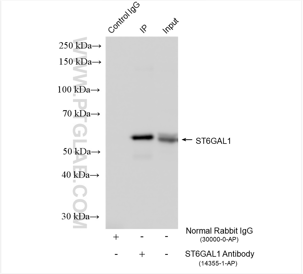 Immunoprecipitation (IP) experiment of Raji cells using ST6GAL1 Polyclonal antibody (14355-1-AP)