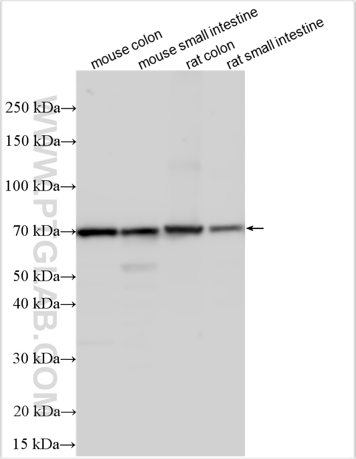 Western Blot (WB) analysis of various lysates using ST6GALNAC1 Polyclonal antibody (15363-1-AP)