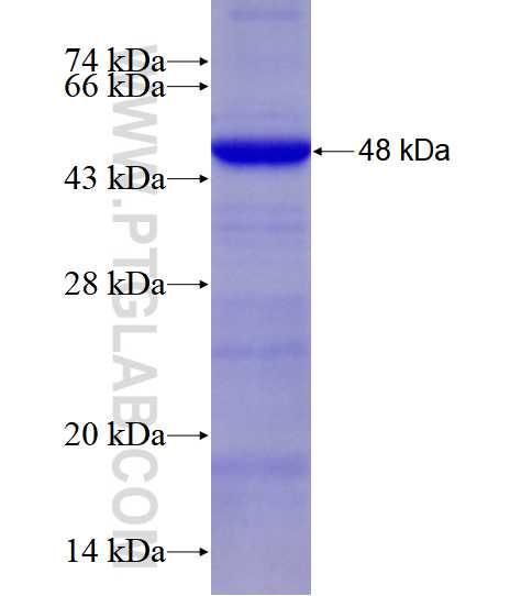 ST7 fusion protein Ag28344 SDS-PAGE