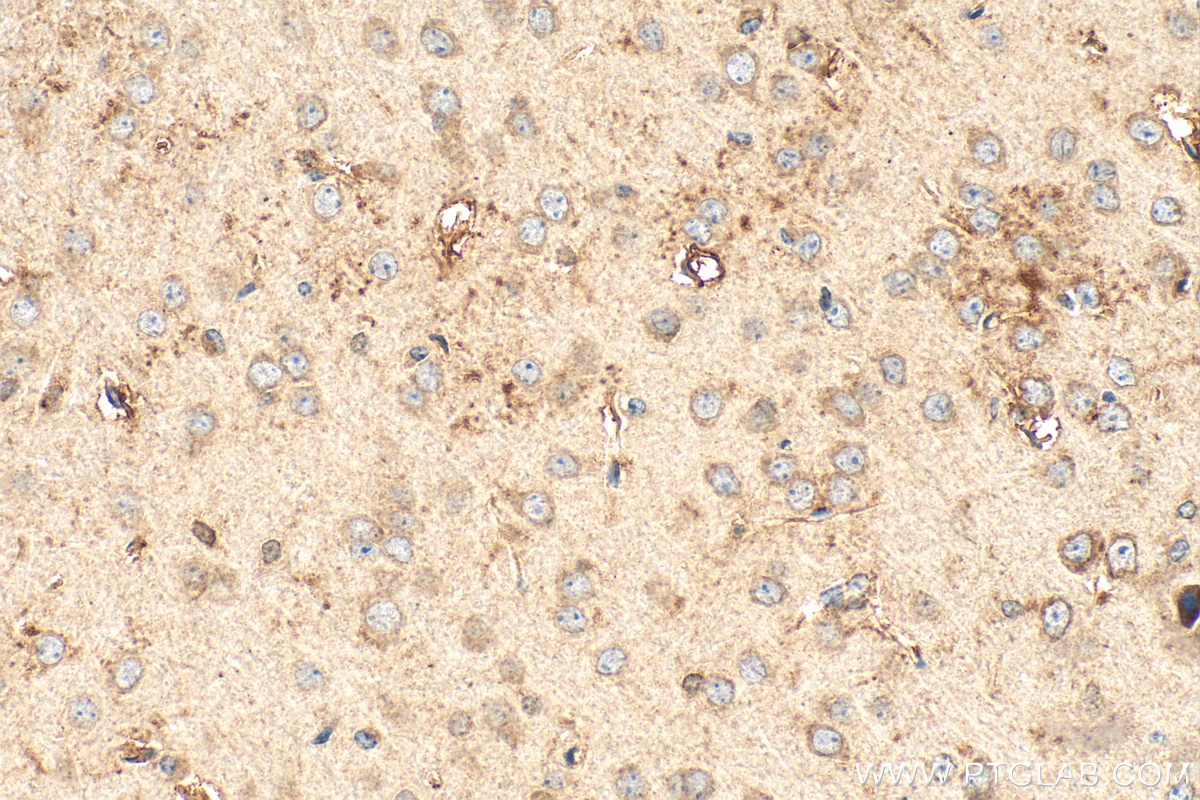 Immunohistochemistry (IHC) staining of mouse brain tissue using ST8SIA1 Polyclonal antibody (24918-1-AP)