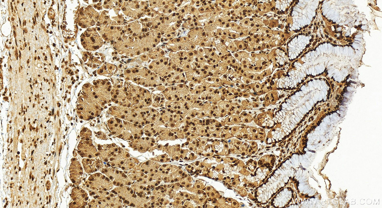 Immunohistochemistry (IHC) staining of human stomach tissue using STAG1 Polyclonal antibody (14015-1-AP)