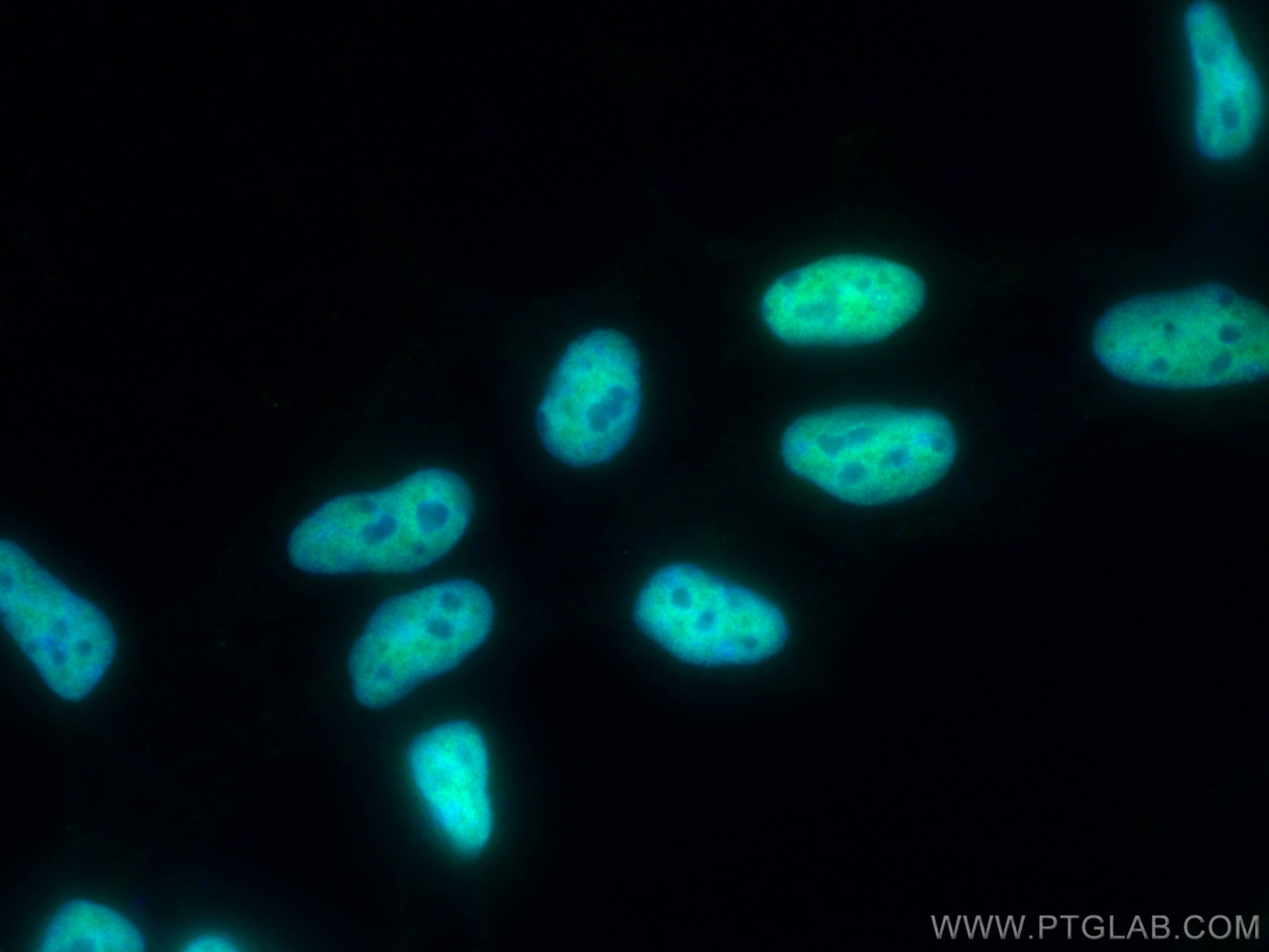 Immunofluorescence (IF) / fluorescent staining of HEK-293 cells using STAG2 Polyclonal antibody (19837-1-AP)