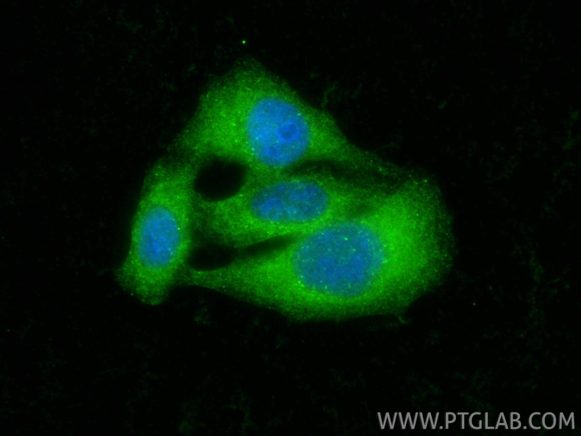 Immunofluorescence (IF) / fluorescent staining of HepG2 cells using STAM Polyclonal antibody (12434-1-AP)