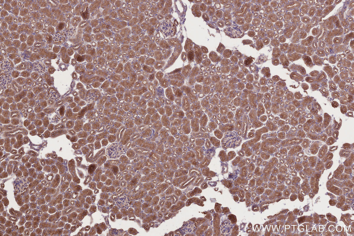 Immunohistochemistry (IHC) staining of mouse kidney tissue using STAM Polyclonal antibody (12434-1-AP)