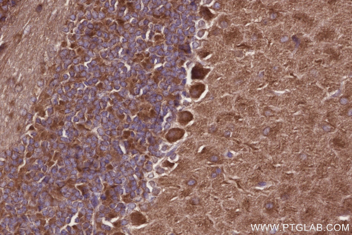Immunohistochemistry (IHC) staining of mouse cerebellum tissue using STAM Polyclonal antibody (12434-1-AP)