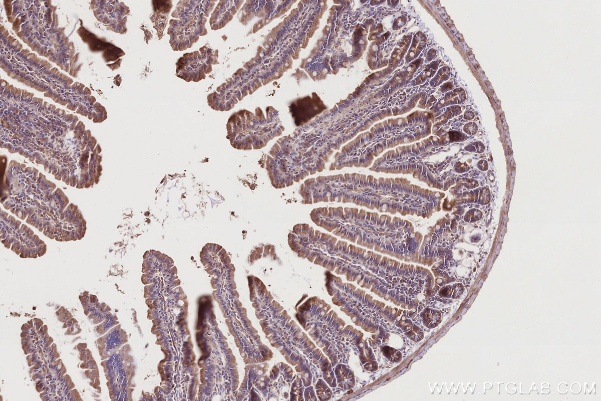 Immunohistochemistry (IHC) staining of mouse small intestine tissue using STAM Polyclonal antibody (12434-1-AP)