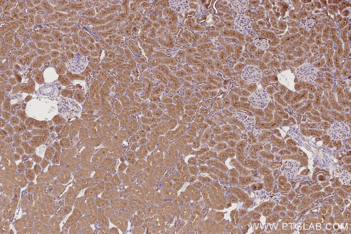 Immunohistochemistry (IHC) staining of rat kidney tissue using STAM Polyclonal antibody (12434-1-AP)