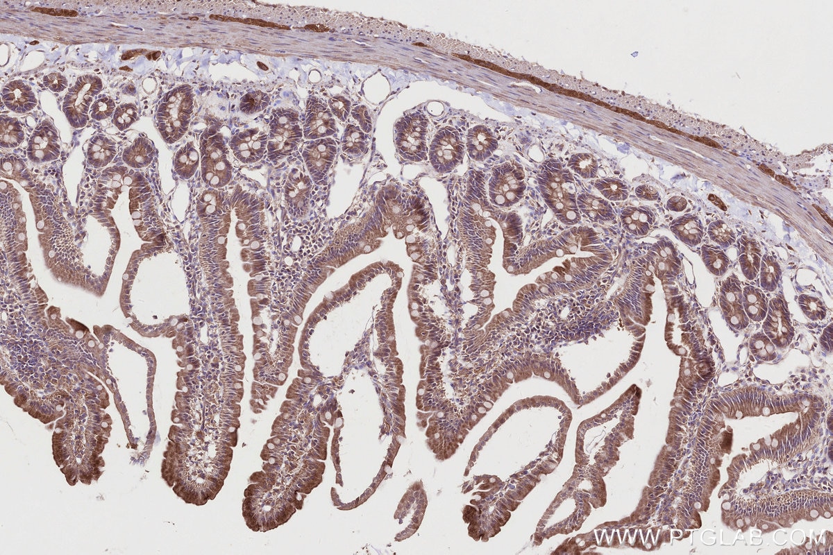 Immunohistochemistry (IHC) staining of rat small intestine tissue using STAM Polyclonal antibody (12434-1-AP)