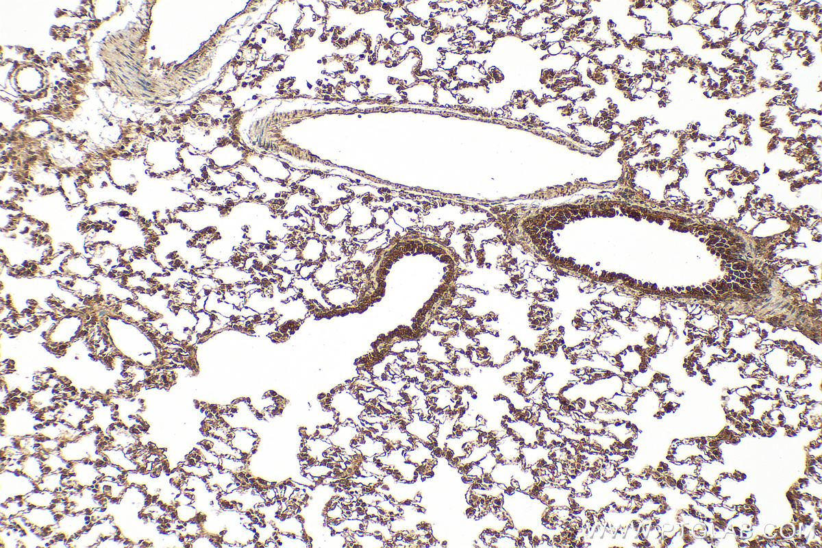Immunohistochemistry (IHC) staining of rat lung tissue using STAMBP Polyclonal antibody (11346-1-AP)