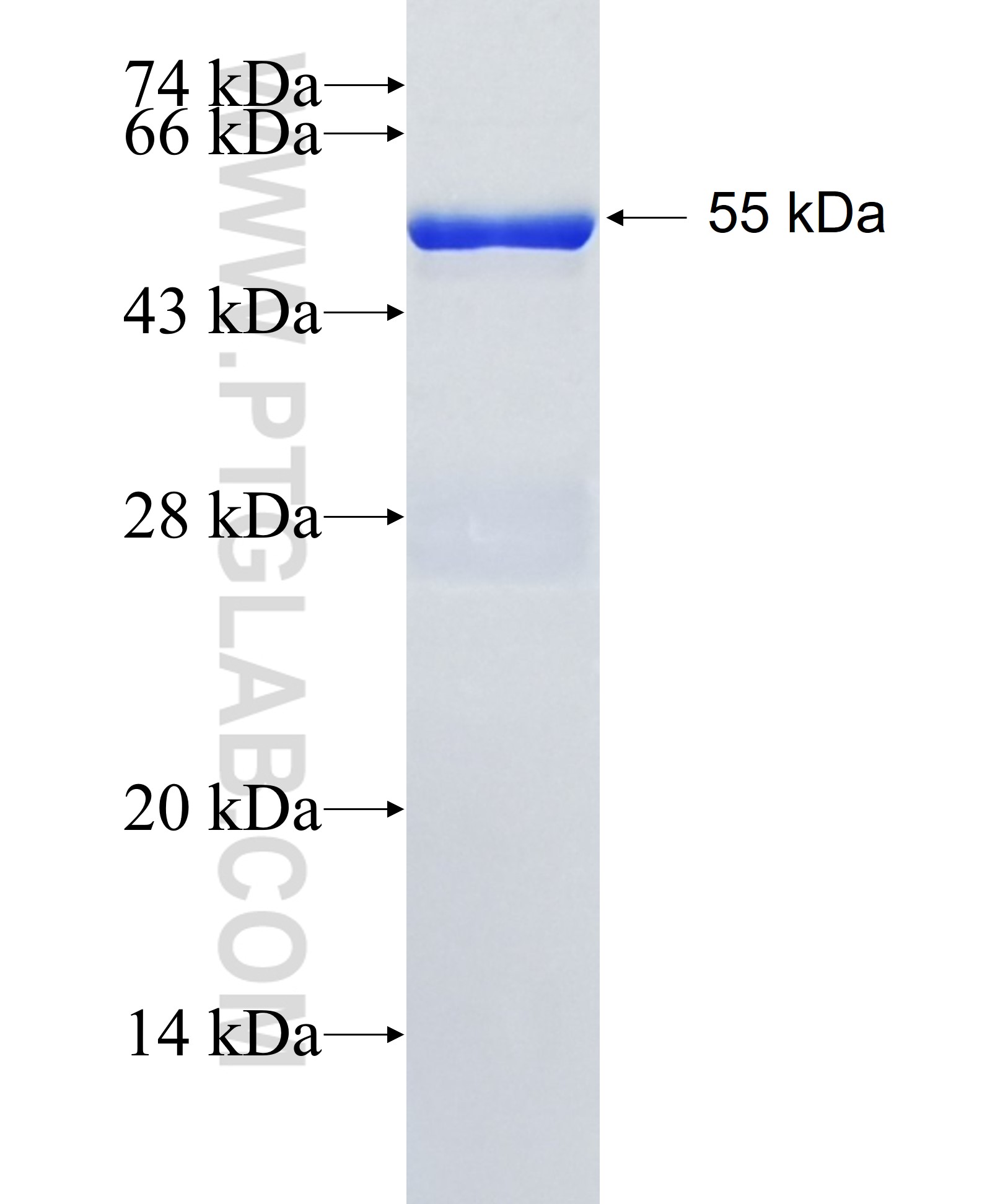 STAP2 fusion protein Ag28818 SDS-PAGE