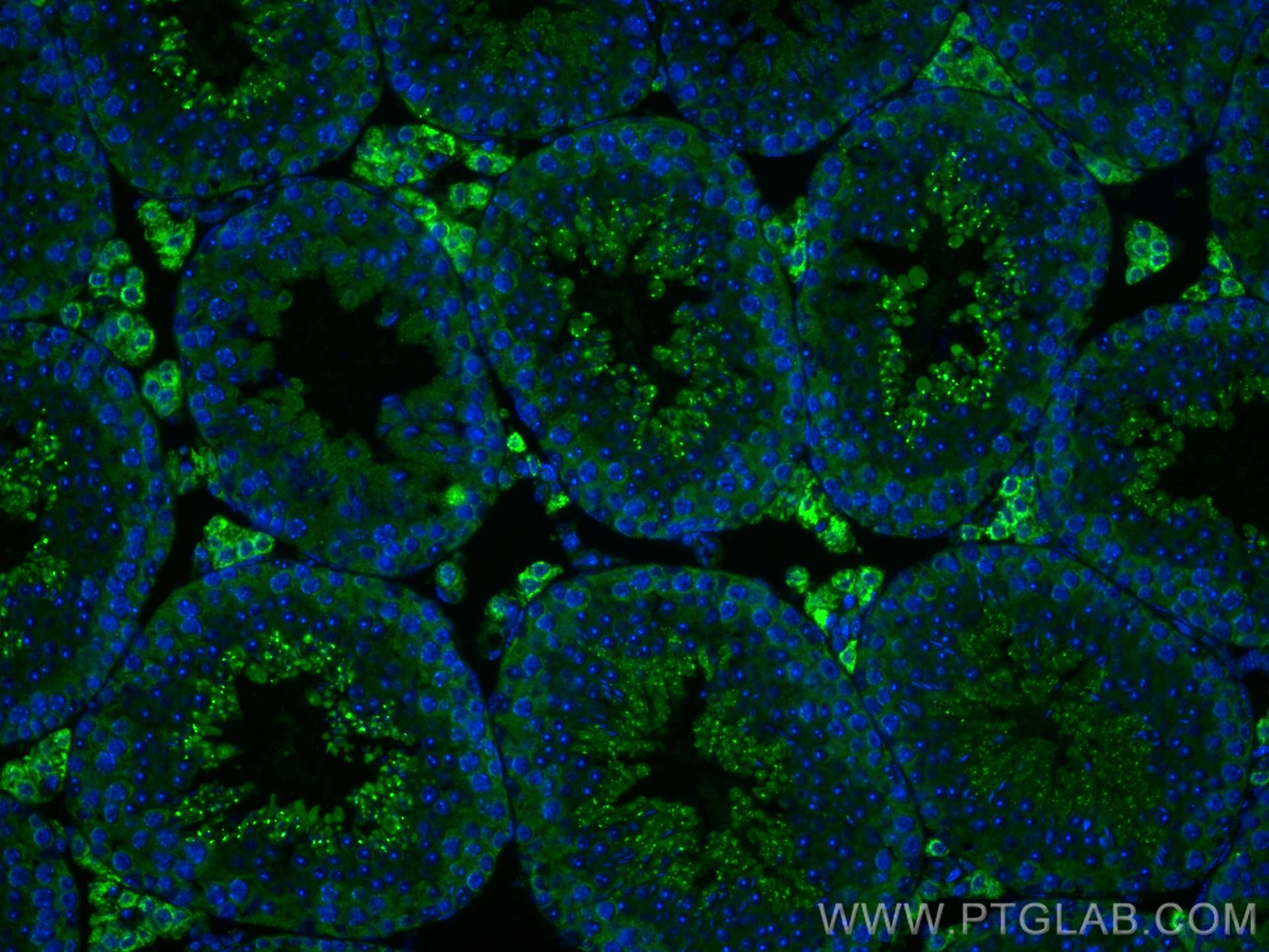 Immunofluorescence (IF) / fluorescent staining of mouse testis tissue using STAR Polyclonal antibody (12225-1-AP)