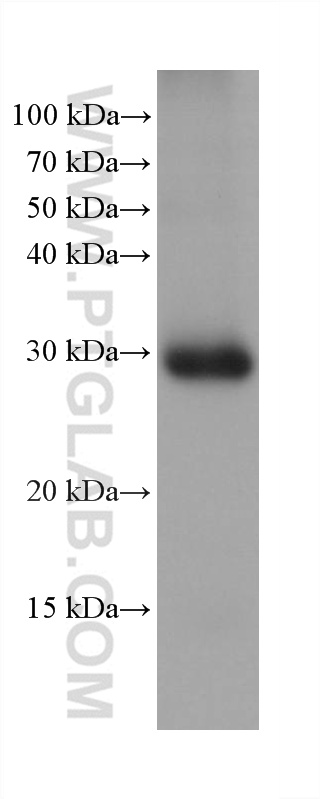 Western Blot (WB) analysis of human adrenal gland tissue using STAR Monoclonal antibody (67130-1-Ig)