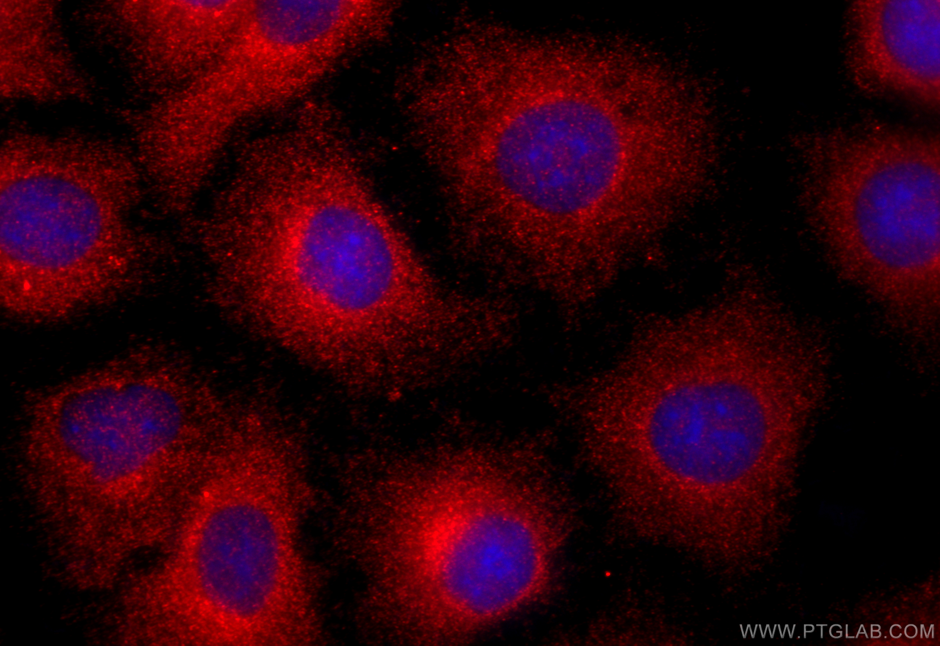 Immunofluorescence (IF) / fluorescent staining of A549 cells using STARD13 Polyclonal antibody (21325-1-AP)