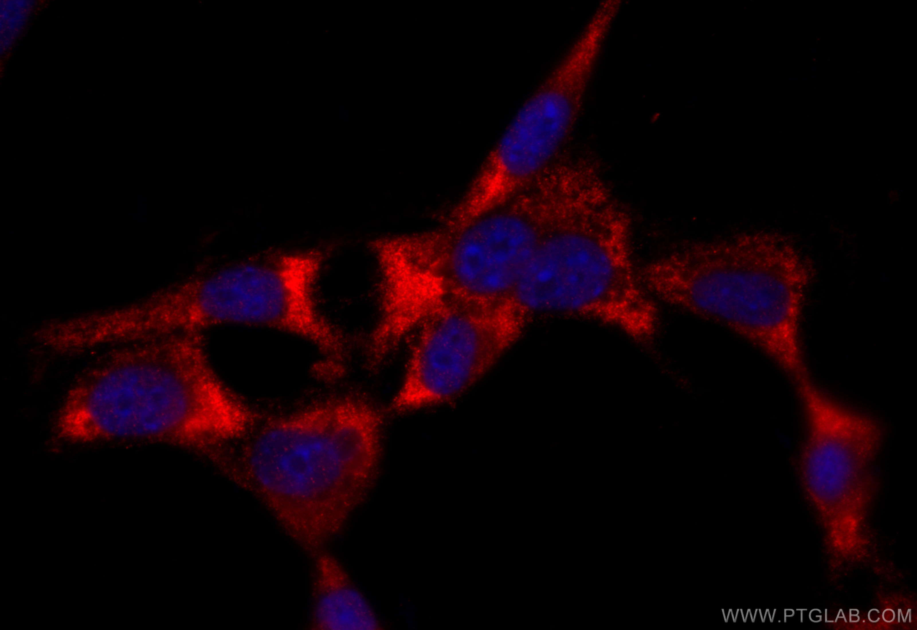 Immunofluorescence (IF) / fluorescent staining of NIH/3T3 cells using STARD13 Polyclonal antibody (21325-1-AP)