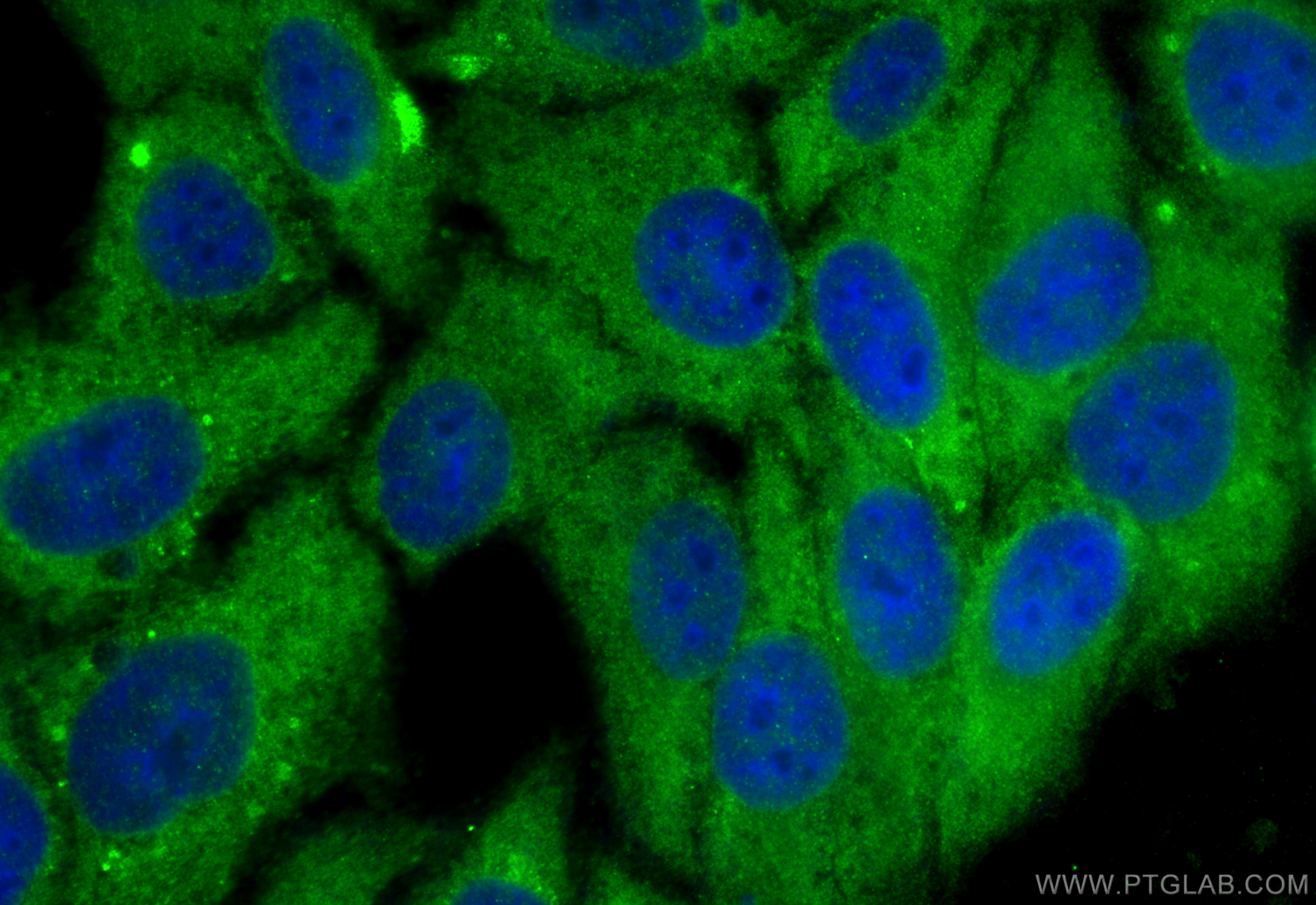 Immunofluorescence (IF) / fluorescent staining of HepG2 cells using STARD5 Polyclonal antibody (10487-1-AP)